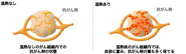 ビオセラクリニック温熱療法　温熱療法後の化学療法が効果的な理由